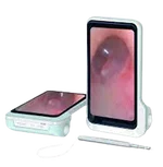 ENT Endoscope